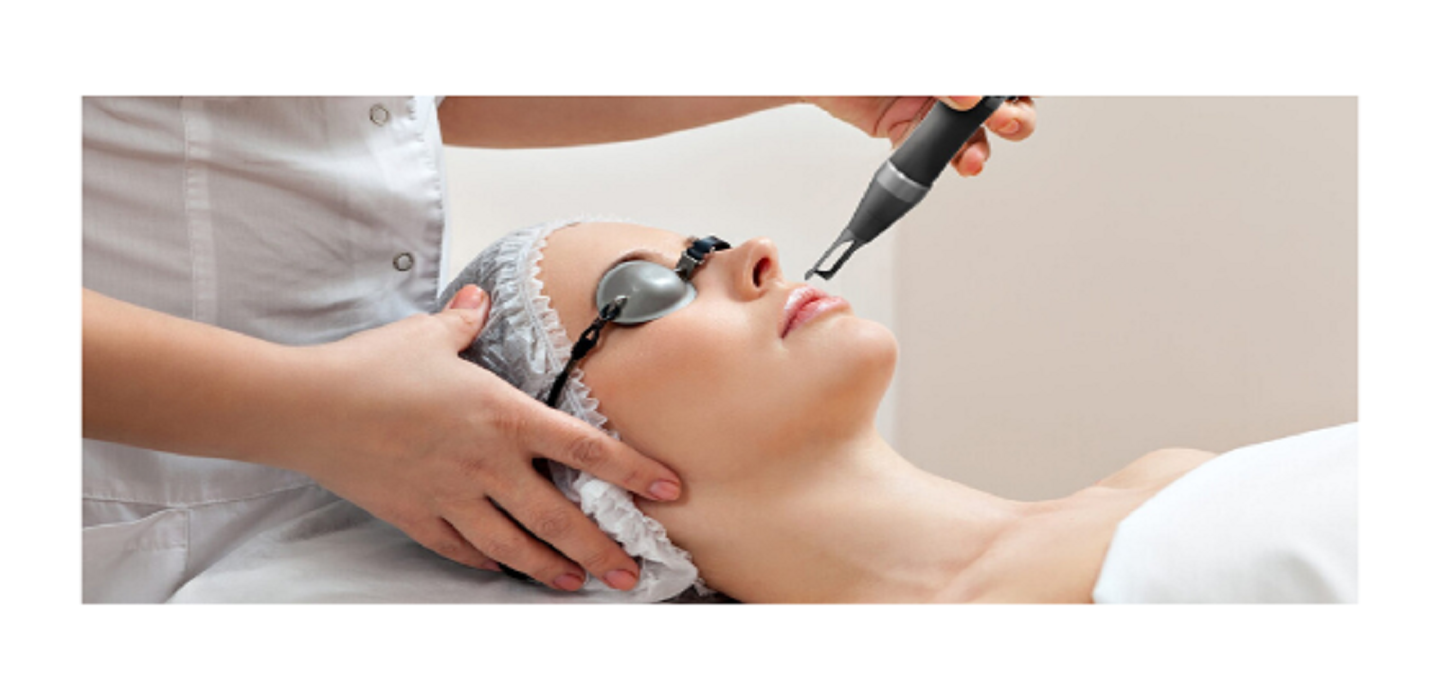 laser treatments