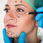 Dermato Surgeries