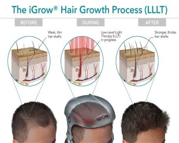 Hair Growth process