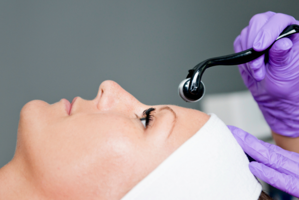 Collagen Induction Therapy_Mayra