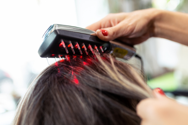 Laser Therapy For Hair Fall_Mayra