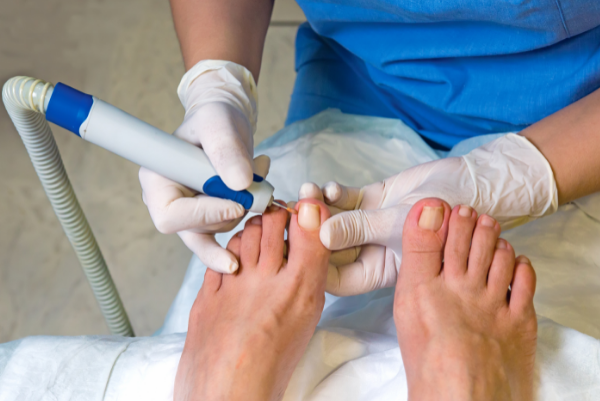 White Toenails & White Spots on Toenails, Explained | Rocky Mountain Foot &  Ankle