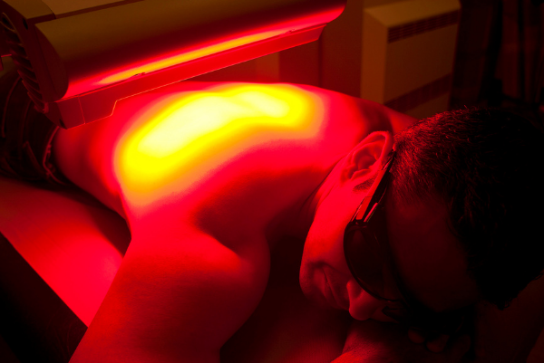 Psoriasis Phototherapy_Mayra